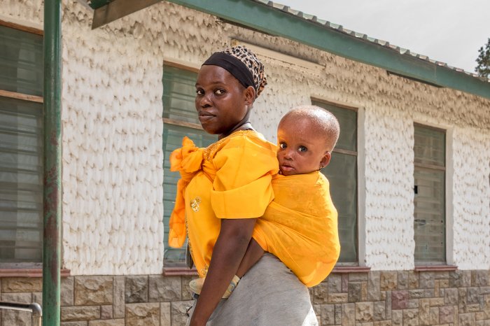 mother with child with hydrocephalus